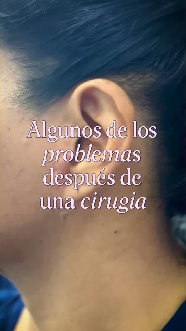 Lifting correctivo: cómo corregir cicatrices y lóbulos estirados
